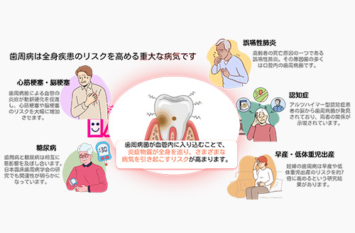 ② 歯の健康は全身の健康に直結するから